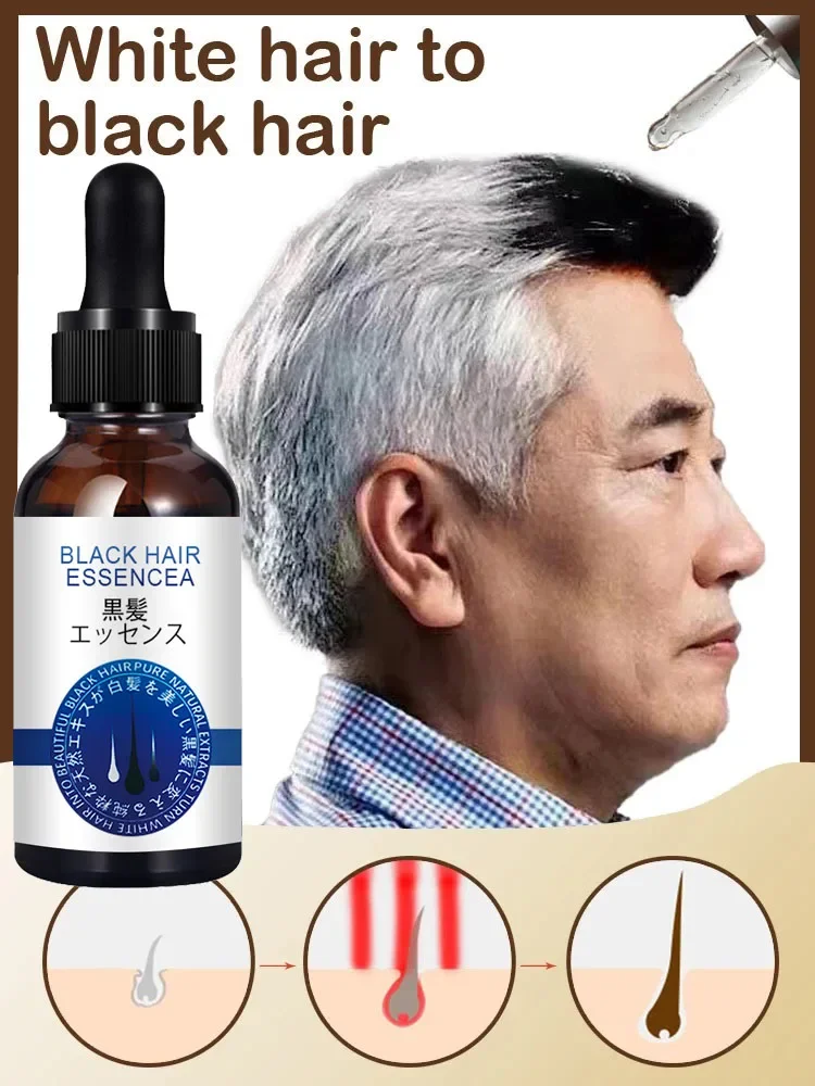 

Anti Gray Hair Essence Blackening Serum Treatment White To Black Hair Repair Care Nourish Scalp Anti Hair Loss NEW