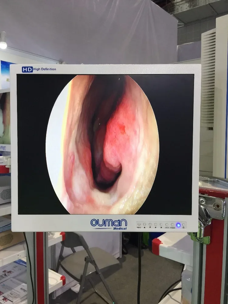 19 Inch Medical LCD observation for Endoscope Device