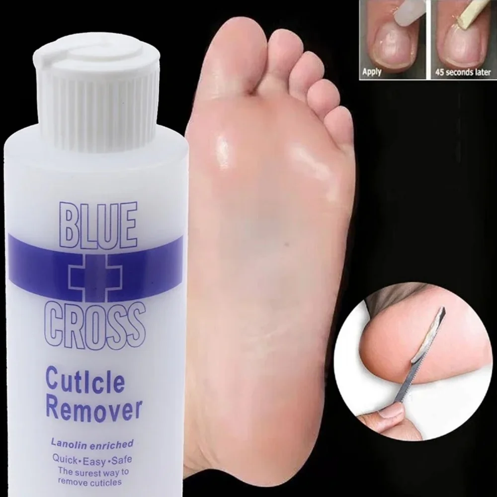 Removedor de cutlcle, removedor de cutícula do pé morto, esfoliante, amaciante, remoção de pele morta e calosidades, máscara para pés, pedicure, intensificador de unhas