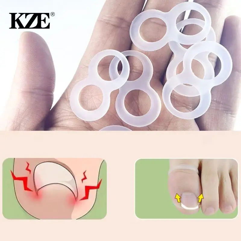 2pcs Silicone Ingrown Toenail Correction Tool Invisible Ingrown Toe Nail Straightening Protector Brace Pedicure Feet Care Tools