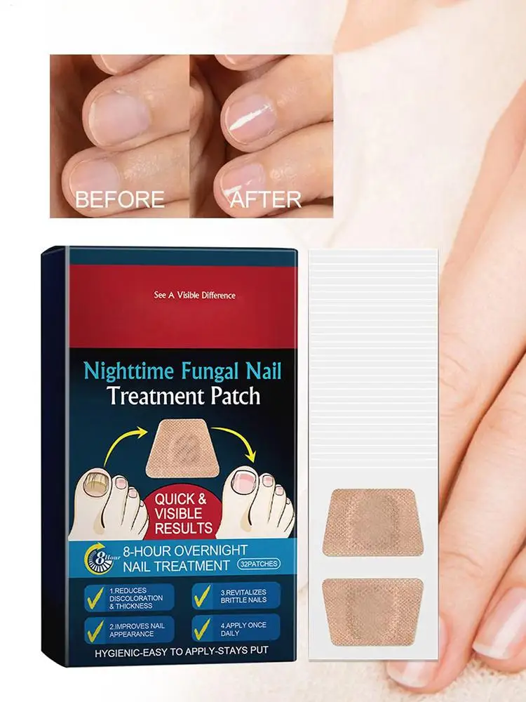 32 個の爪真菌パッチ防水ネイル修復パッチ変色または損傷した爪用の爪陥入爪矯正ステッカー