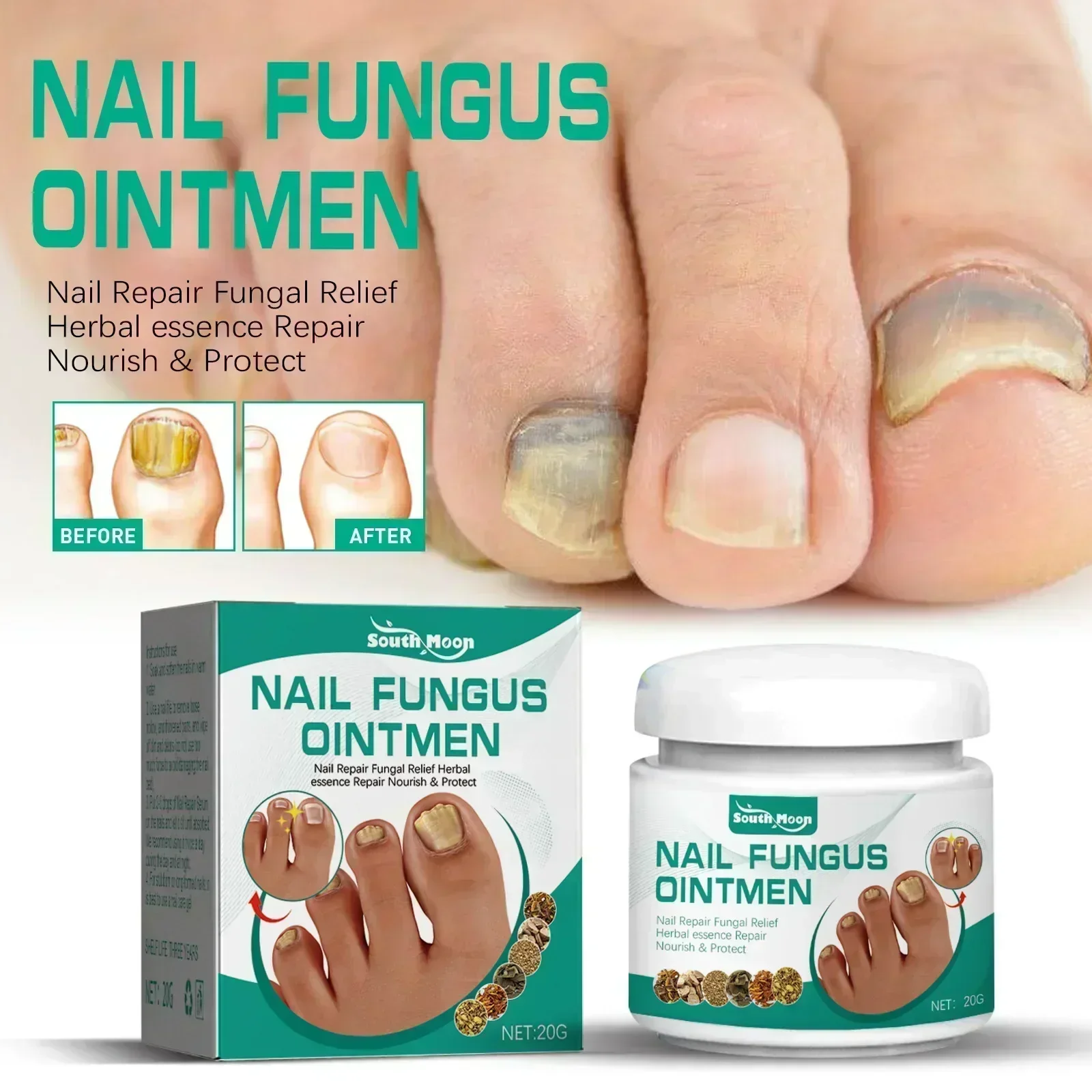 Fungal Nail Treatment Oil Foot Repair Essence Toe Nail Fungus Removal Gel Anti Infection Cream Fungal Nail Removal Paronychia