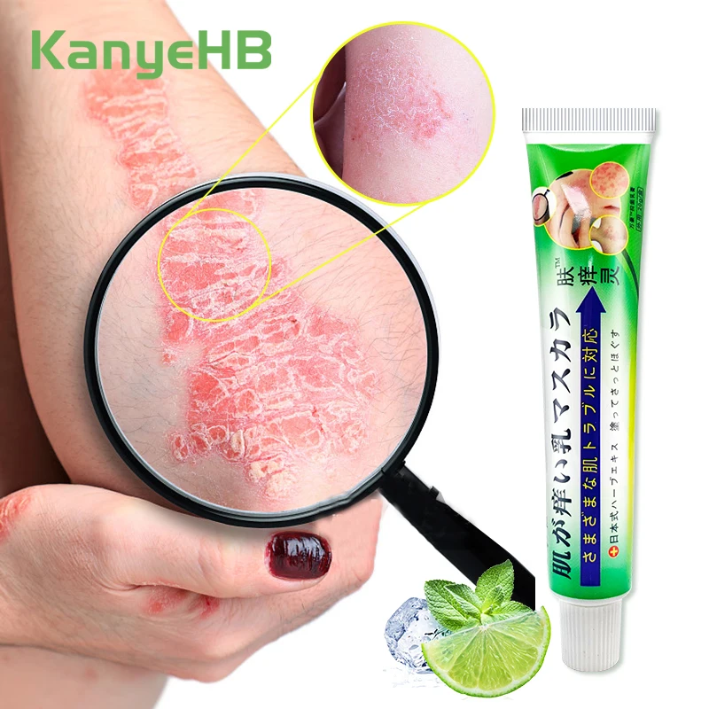 

1pc Snake Oil Psoriasis Antipruritic Antibacterial Ointment Mint Antipruritic Ointment Relieve Pain Detumescence Ointment S111