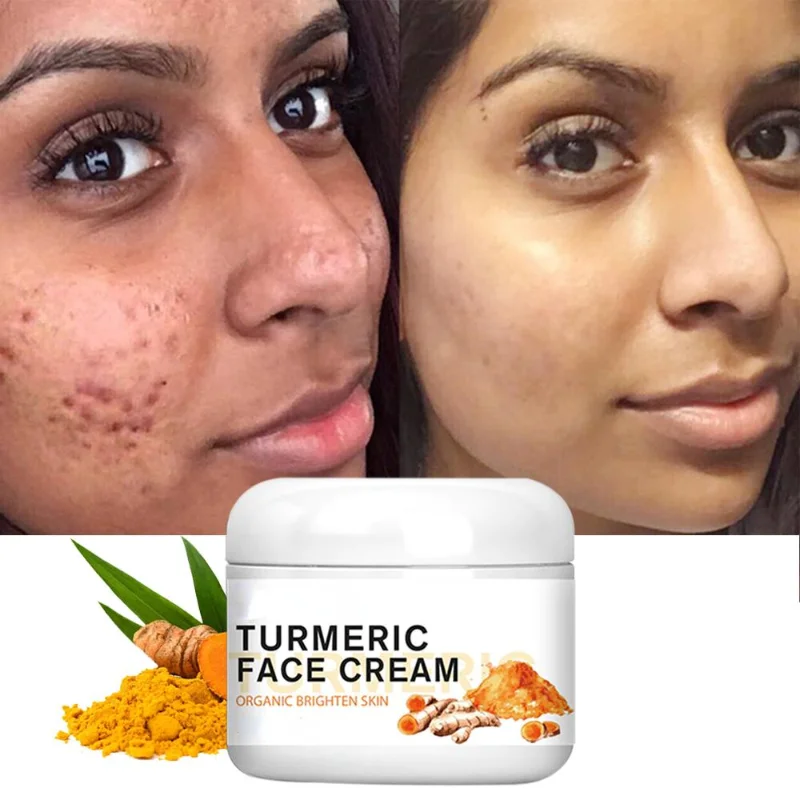 

New Turmeric Face Whitening Cream for Dark Skin Remove Acne Lighten Dark Spots Moisturizing Brightening Cream for Face Skin Care