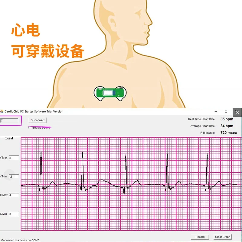 BMD101 Sensor Module ECG Chest Close Heart Rate HRV Wearable Device ECG Sensor Bluetooth BLE4.0