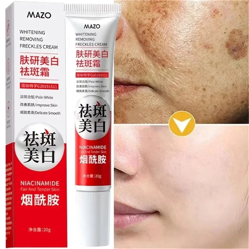 

Powerful Spot-Removing Whiten Cream Brighten Skin Fast Eliminates Melanin Pigmentation Melasma Dark Spots Korean Skin Care 20g