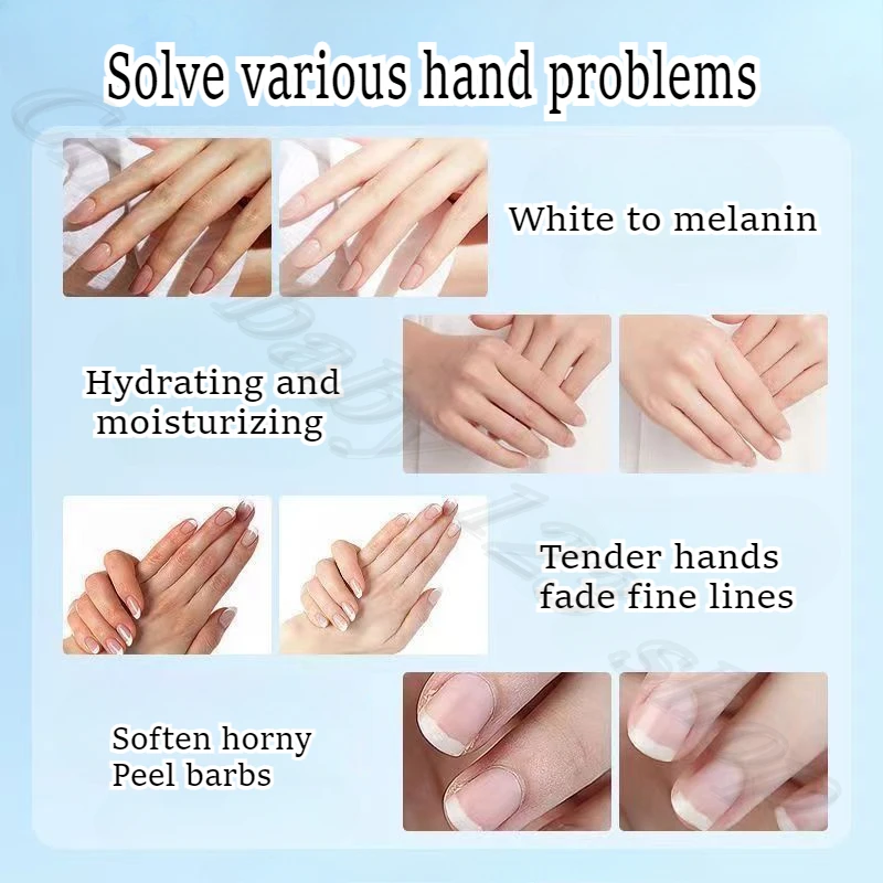 Collagen Single Capsule Hand Essence Oil Moisturizing Anti-cracking Barb Desalination Hand Pattern Repair Hand Cream 100 tablets