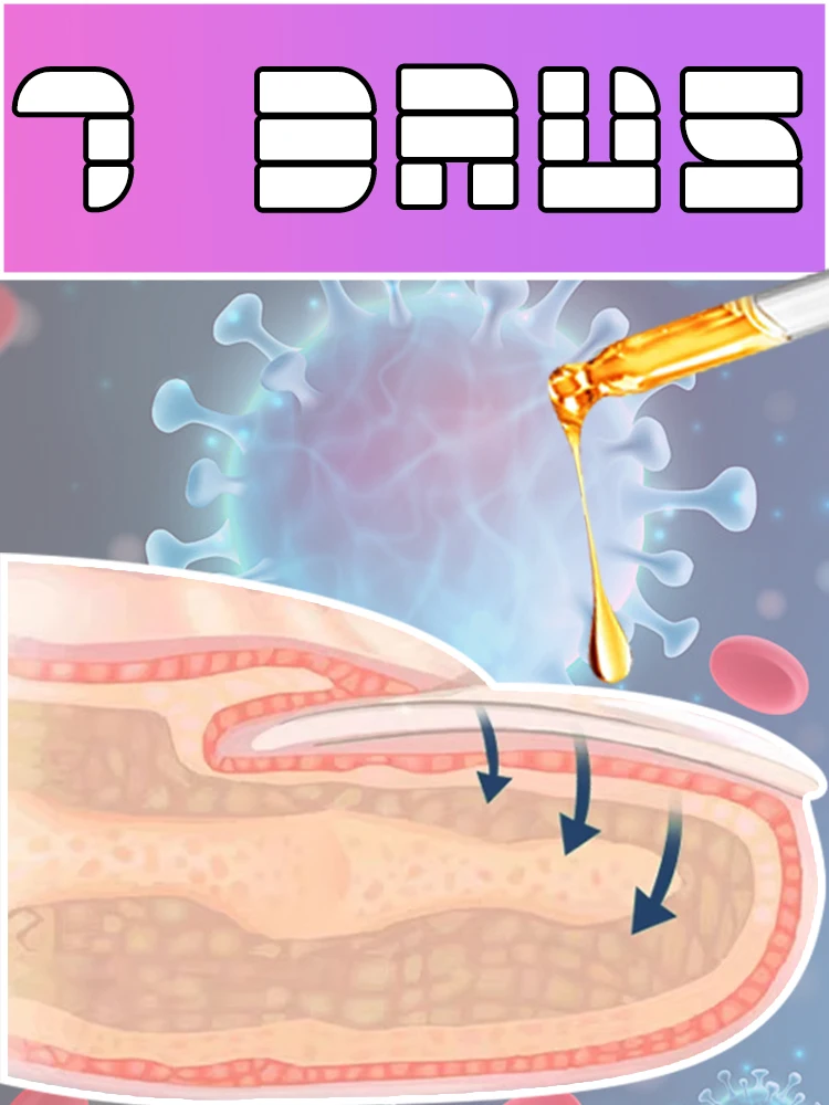 

Quickly eliminate fungus and restore healthy nails