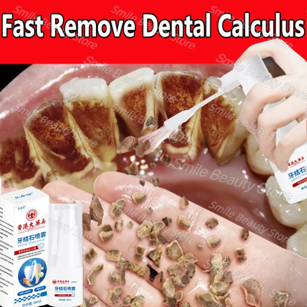 Dental Calculus Remover Teeth Whitening Spray Toothpaste Cleaning Oral Hygiene Removal Halitosis Plaque Stains Fresh Breath Care