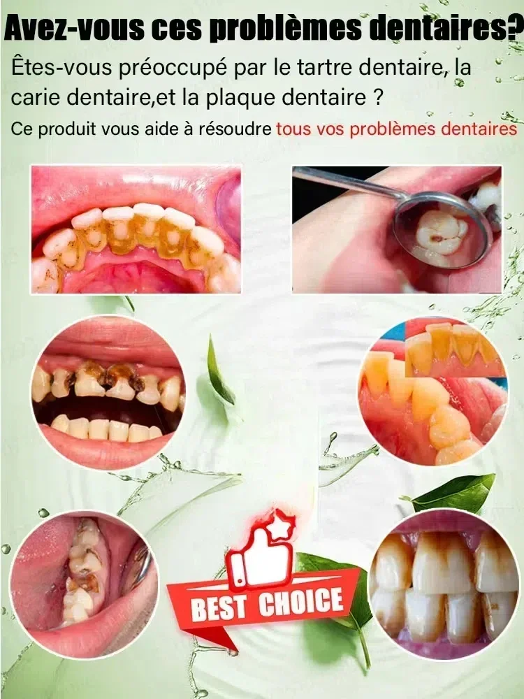 02 Teeth Whitening Repair of Cavities Caries Removal of Plaque Stains Decay Repair Teeth Treating Dental Calculus