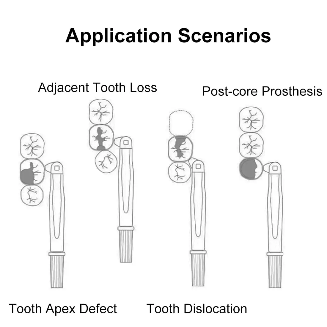 Dental Pro Matrix Bands Sectional Bands, Adjustable Retainer and Matrix, Sectional Contoured Matrice Roll Type for Crownwork