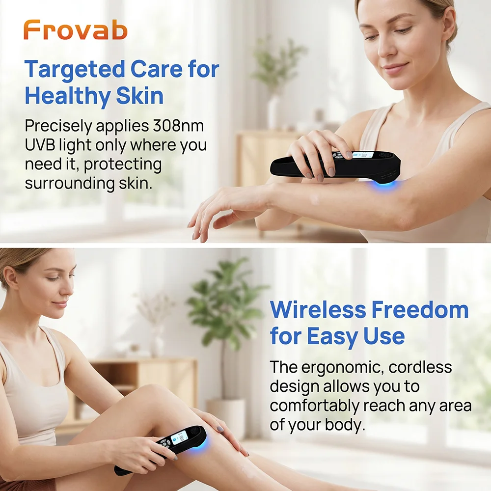 

Precision 308nm UVB Light Therapy Device Handheld Rechargeable Phototherapy Lamp for Face Hands Vitiligo Psoriasis Small Spot