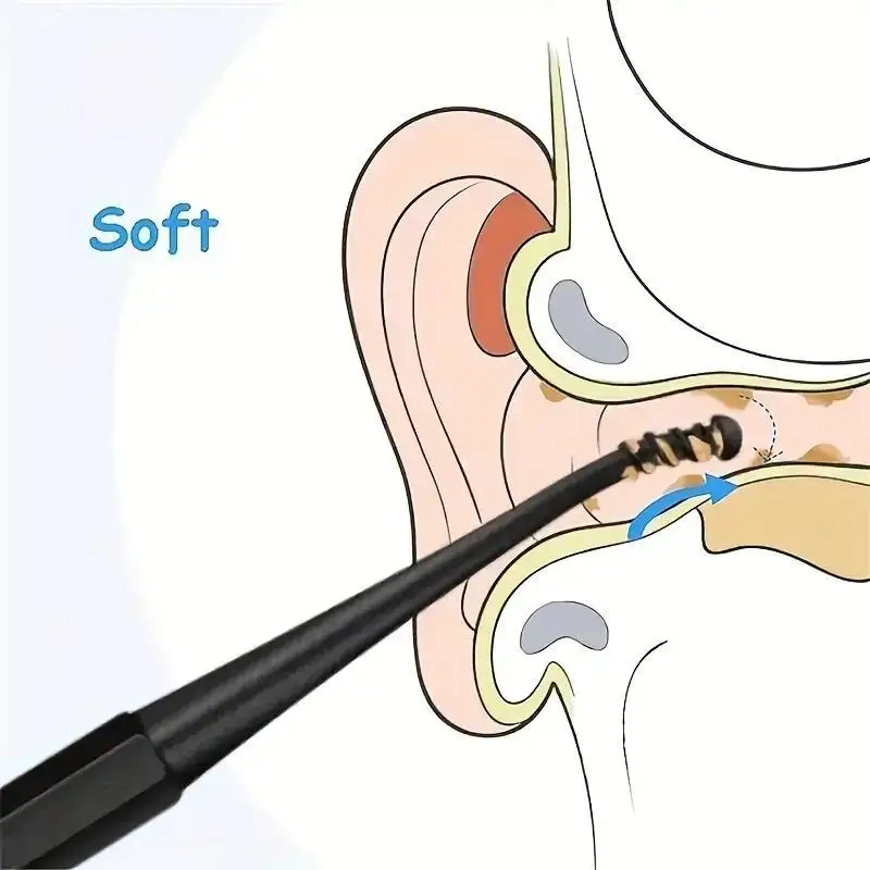 2pc Spiral Ear Spoon, Double Headed Rotating Ear Digging Spoon, EarPicking Tool, Double-Ended Earpick, Clean Ear Safety