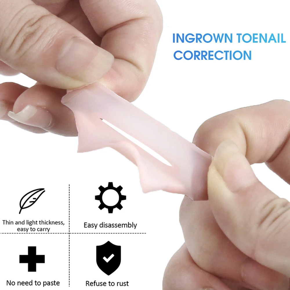 Pexmen 2/4/10Pcs Gel Ingrown Toenail Corrector Sleeves Big Toe Nail Healing Care Protector Paronychia Treatment Pedicure Tool