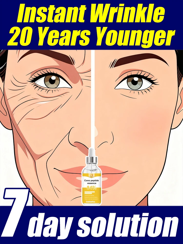 

No wrinkles and No fine lines