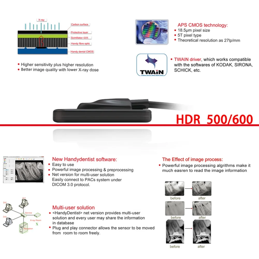 Dental Sensor Digital X-ray Intraoral Sensor HDR 600 High Frequency RVG Imaging System with Mutil Languages Software