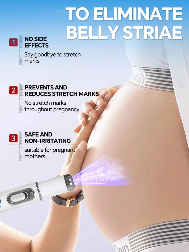 Striae Blue Light-apparaat Elimineert lichaamsstriae Producten Gereedschappen
