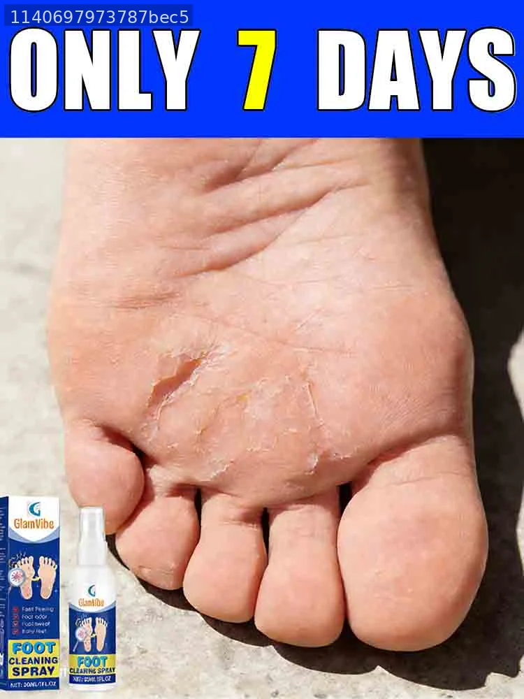 

Прощай, сухие, шелушащиеся ступни! Получите мягкие, гладкие стопы уже через несколько дней.