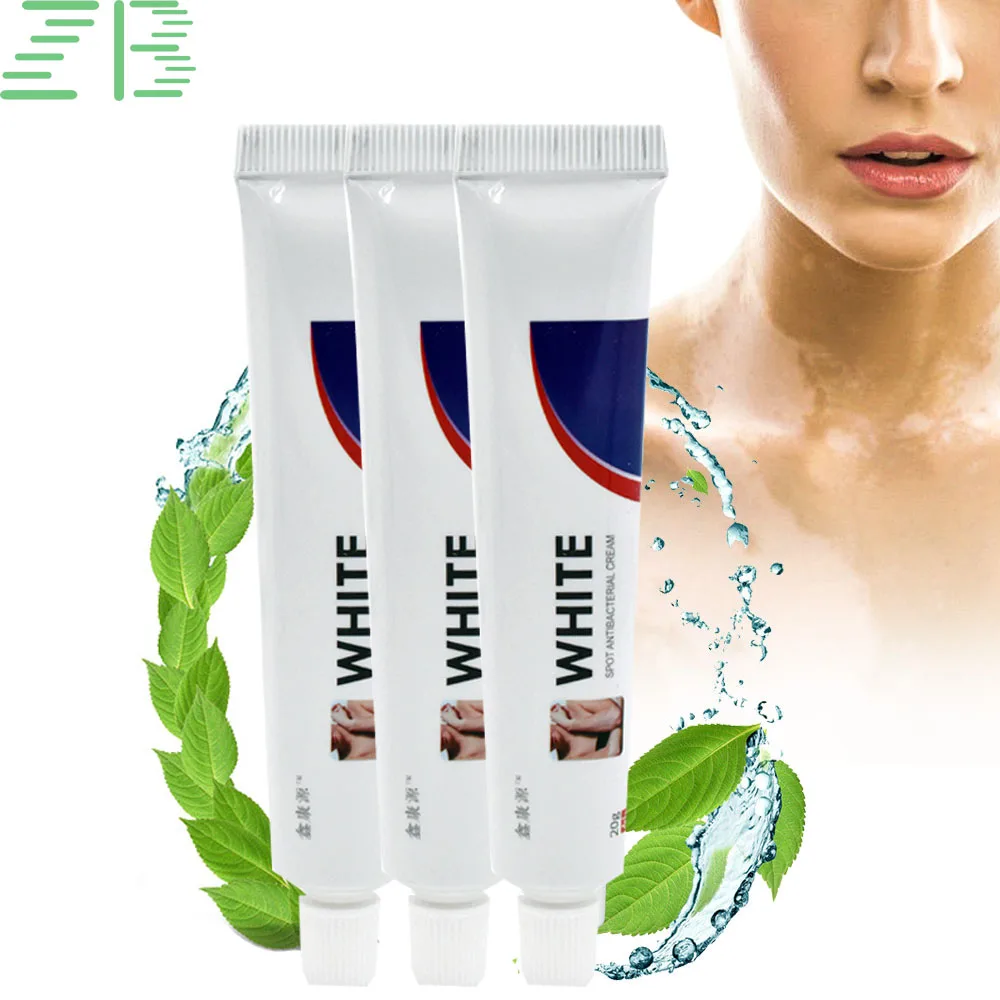 

20g ZB Herbal Extract Vitiligo Ointment Remove Ringworm White Spot Removal Skin White Spot Leukoplakia Disease Treatment Cream