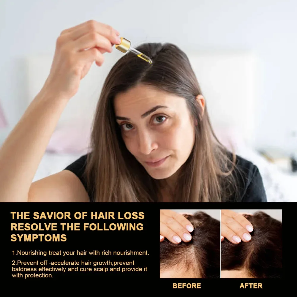 

Набор для быстрого роста волос Батана Oil Traction Alopecia Маска для волос против выпадения волос Масло для роста волос Лечение облысения Уход за волосами