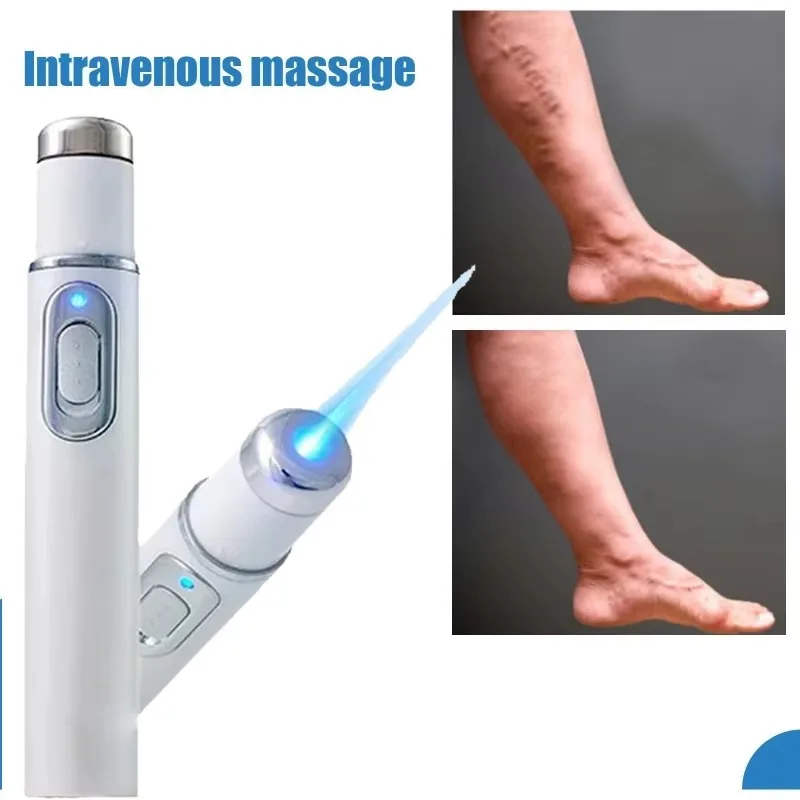 Varicose Veins Treatment Improve blood circulation Angiitis Legs Dilated Relief Vasculitis Phlebitis Spider Leg Varicosity Foot