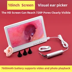Professional 10.1inch HD Large Screen Visual Ear Picking Endoscope, illuminated Ear Digging Tool for Ear Canal Inspection