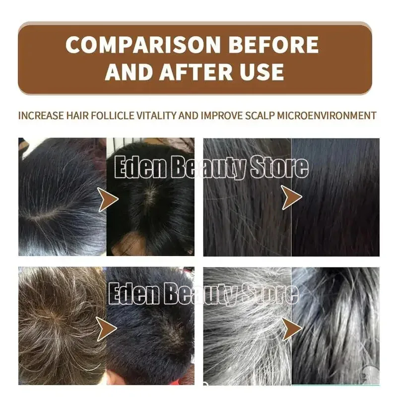 Herbal Anti-grey Hair Treatment Serum Cream White To Black Permanent Repair Natural Color Nourish Scalp Hair Care Products