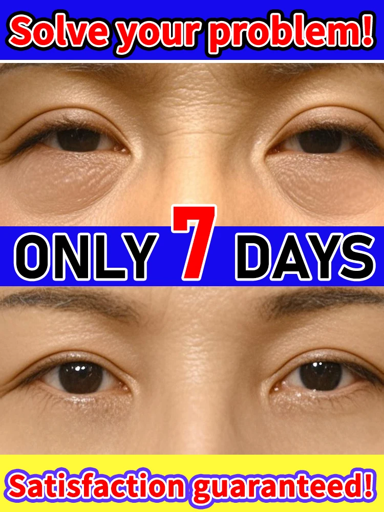 

Morning Rescue Eye Gel: Instantly De-Puff Puffy Eyes & Reduce Swelling