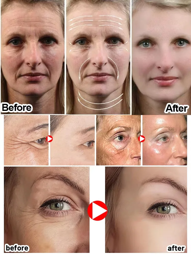Collageen Rimpel Remover Gezicht Serum Verstevigende Lift Anti Aging Vervagen Fijne Lijntjes Whitening Fleuren Hydraterende Huidverzorging Cosmetica