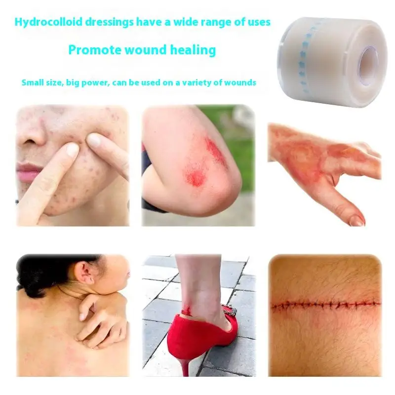 1 rouleau de pansement hydrocolloïde pour un soin efficace des plaies, ruban de couverture de cicatrice auto-adhésif Extra fin, doux et imperméable