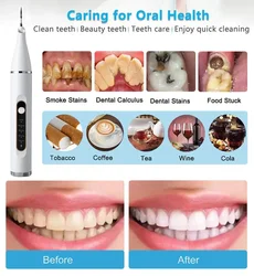Dental Ultrasound Scaler Electric Tooth Cleaning Tool Oral Care Plaque Spatula Removes Tartar Dental Scraper for Teeth Whitening