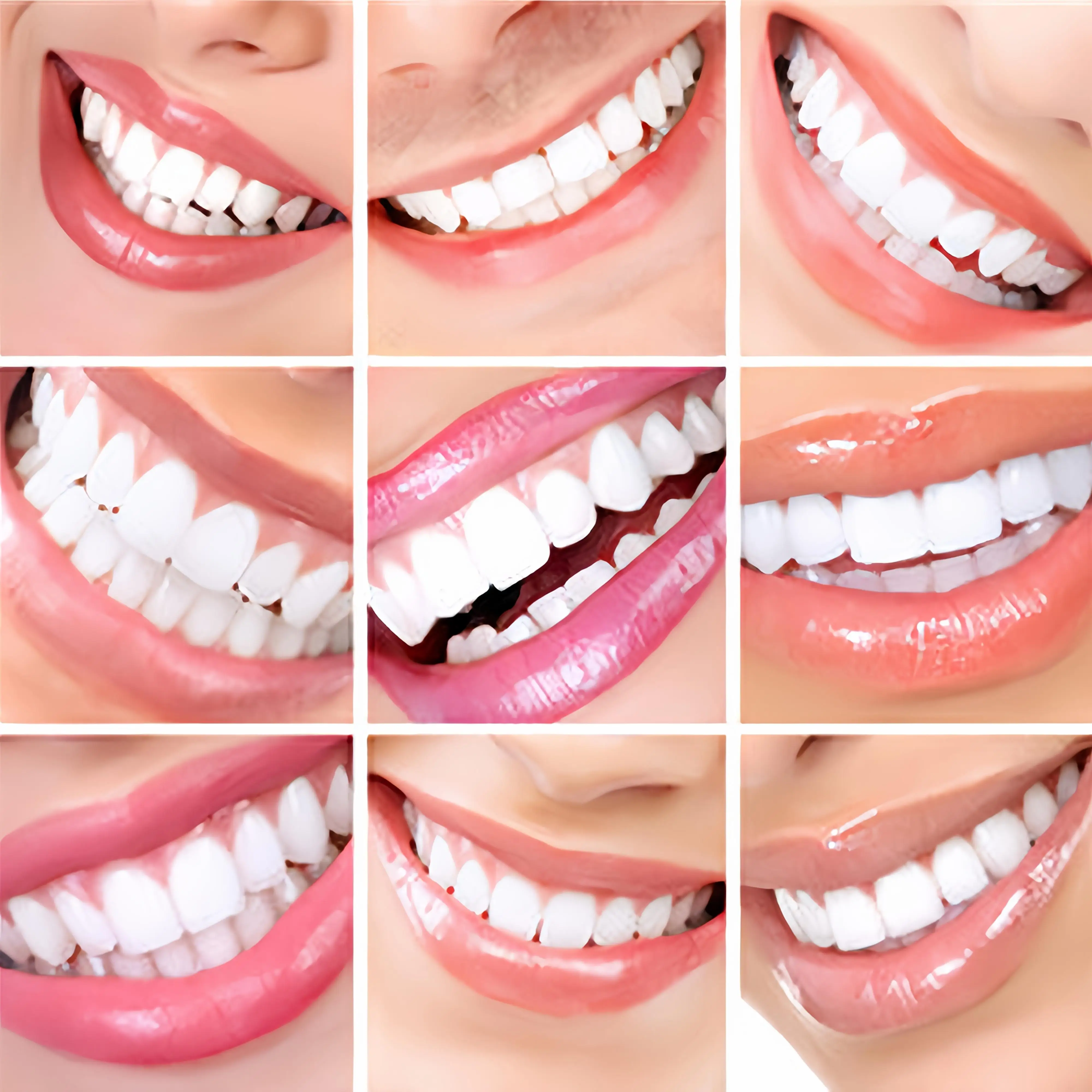 

newInstant Cosmetic Teeth Veneers Silicone Reline Kit for Missing Restoration CK848