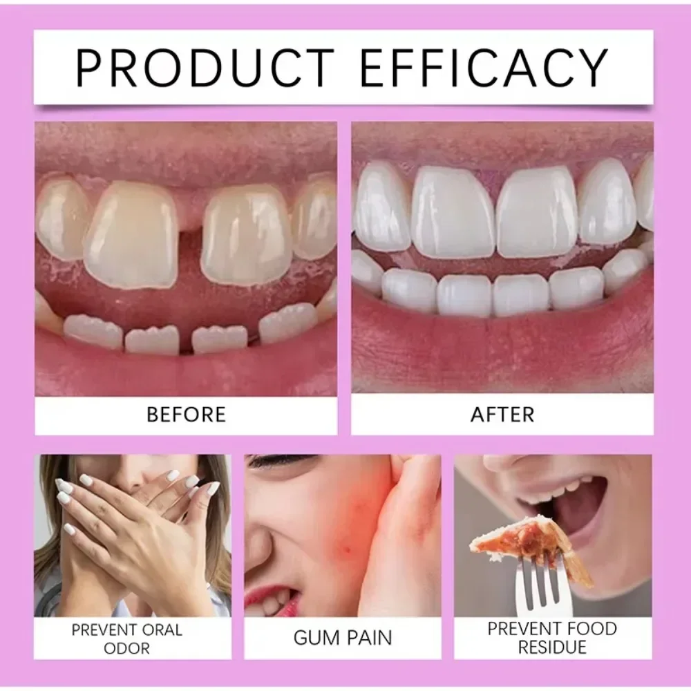 الراحة أسنان المواد اللاصقة الغراء العناية بالأسنان طقم أسنان من السيليكون ريلين كيت لاصق وسادة الاحتكاك أطقم الأسنان الثابتة