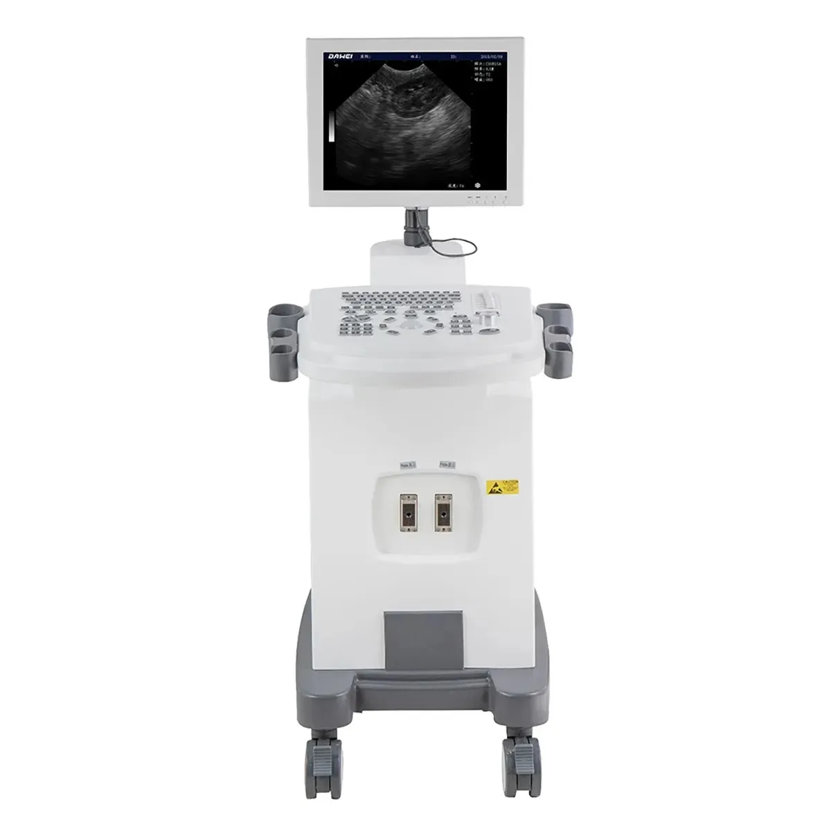 Pregnant Ultrasound Machine scanner  Doppler Veterinary Ultrasound Systems Trolley