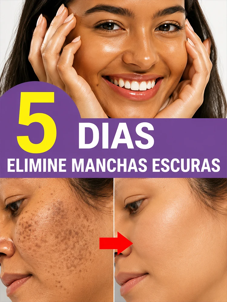 Potent Pigmentation Clearing Serum Melanin Suppressor Freckle Reduce Dark Mark Remover Radiant Whitening