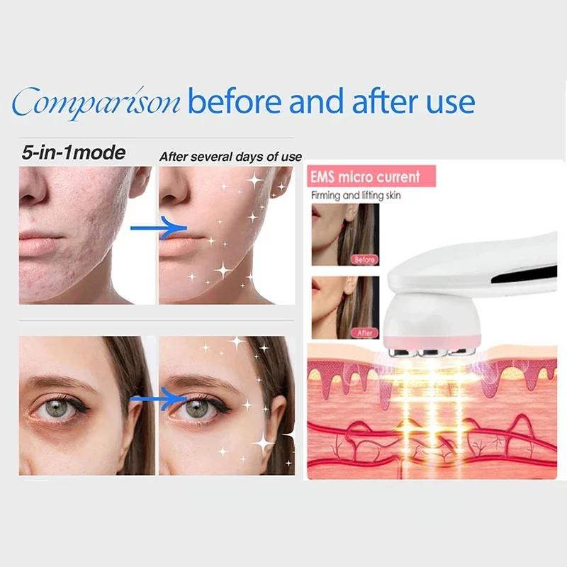 Radiofrequência Facial LED Photon Beleza Dispositivo, Cuidados Com A Pele Máquina, Rosto, Remoção De Rugas, Levantamento, Apertar, 5 Cores, RF