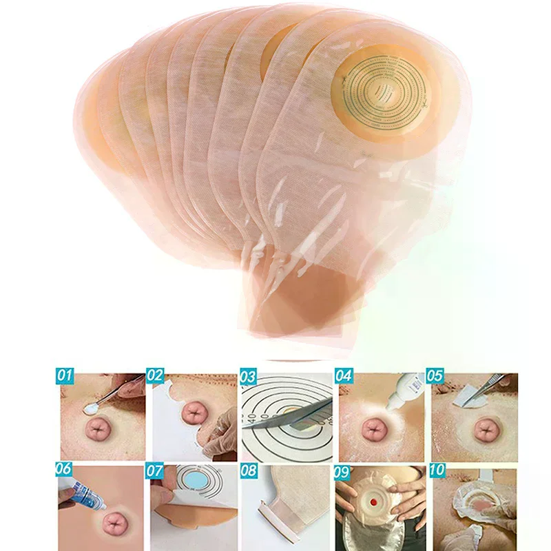 10pcs Colostomy Bags Max Stoma Skin Color Ostomy With Hook & Loop Back Window Drainable Pouch