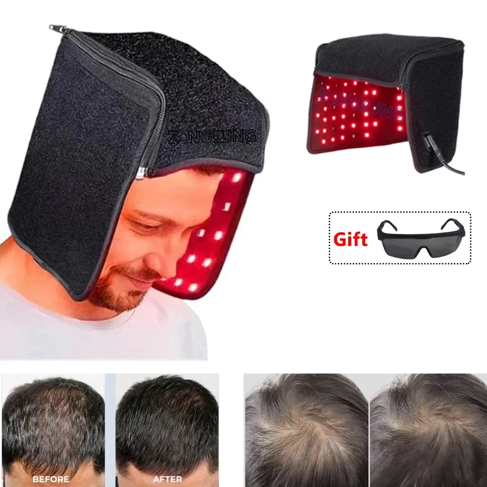 LED Red Light Therapy Hat for Hair Growth 215 Bead Lights Anti Hair Loss 660nm&850nm Light Treatment Laser Helmet Strong Hair