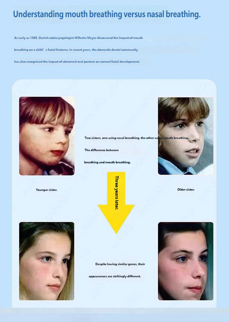 30-150 Stück Kinder-Cartoon-Katzen-Schlafmundstreifen, atmungsaktives Klebeband zur Lippenversiegelung für besseren Schlaf bei Kindern – Detail 3