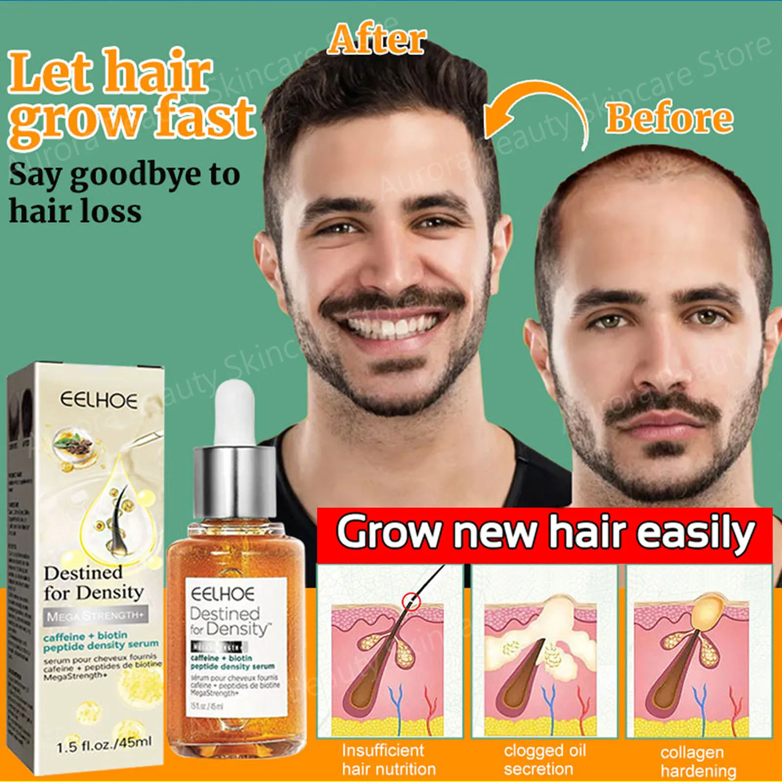 Aceite para el crecimiento rápido del cabello, tratamiento folículo seborreico, Alopecia, línea capilar hacia arriba, posparto, previene la pérdida del cabello, productos para la calvicie