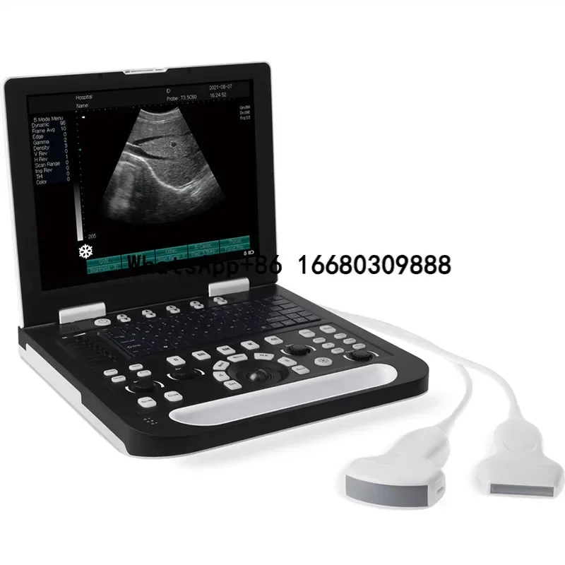 xundi N50 Portable 15 Inch Diagnosis Ultrasound Probes Medical BW Laptop Ultrasound Machine With Scanner