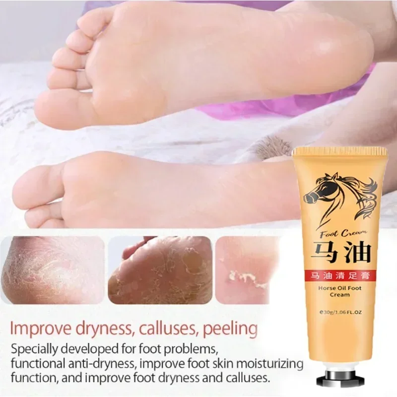 ²⁰²⁵ Horse Oil Skin Cream Anti-cracking Ointment Prevents Dry Skin Moisturizes Protects Fingers Feet and Skin Care Products