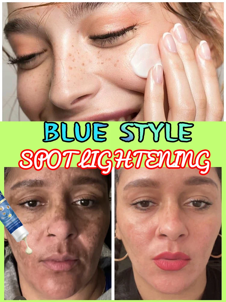 

2025's Hottest Spot and Dark Spot Removal Products