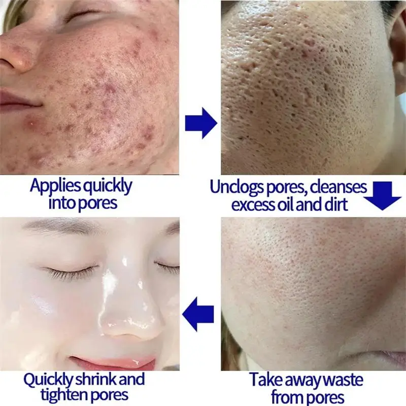 Crema facial para reducir los poros, suero reparador de ácido salicílico para reafirmar los poros grandes, eliminar los puntos negros, piel rugosa y