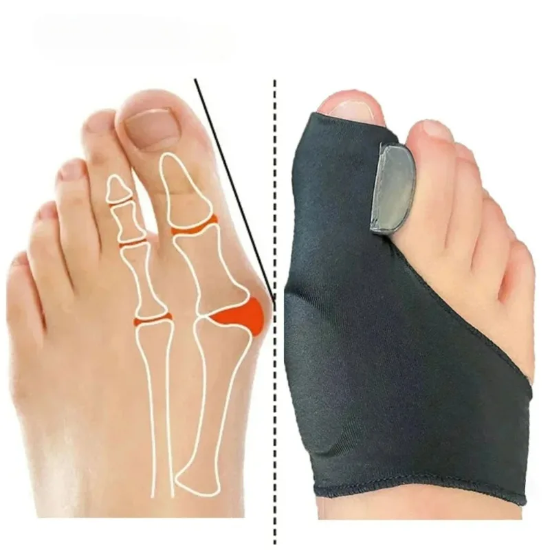 1Pair Toe Separator Bunion Corrector Orthotics Foot Bone Thumb Adjuster Orthopedic Pedicure Sock Straightener Tool