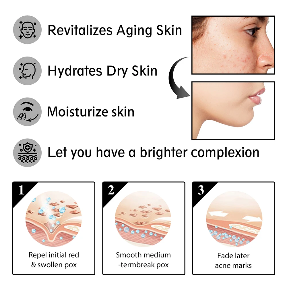 Snail Serum Cream Anti Wrinkle Cream Face Moisturizer Face Lifting Cream Anti-aging Essence Face Whitening Cream Skin Care Tool