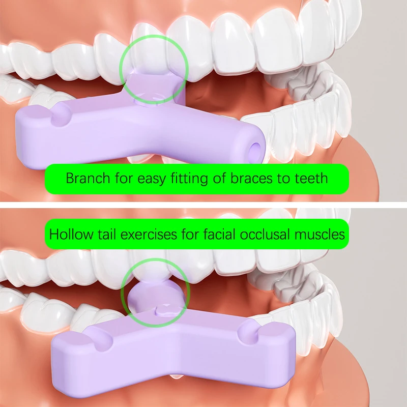 1ชิ้นซิลิโคนฟันติดกัดจัดฟันจัดฟันจัดฟันแบบ Chewies ป้องกันใบหน้าผิดรูป