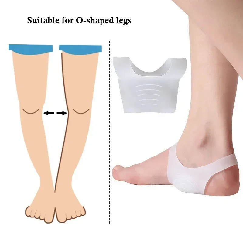 GEL Orthopedic Insoles Foot Pads Silicone Arch Support for Plantar Fasciitis Foot Valgus Varus Corrector Pain Relief Foot Care