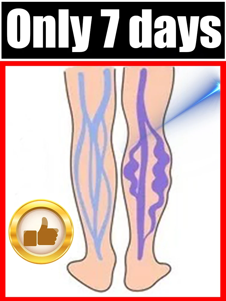 

Find Your Leg's Natural Balance: Focus on Comfort and Feeling Your Best