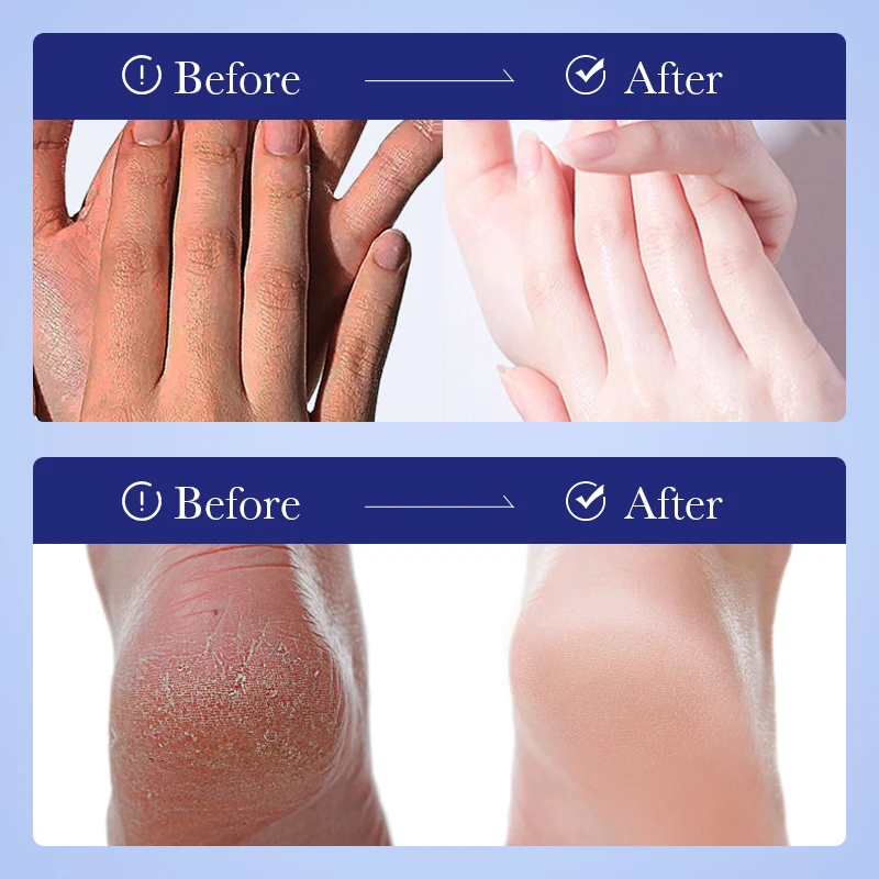 كريم FAYANKOU اليوريا للوجه والجسم 100 جرام مغذي ومرطب للبشرة المتشققة وإصلاح العناية الجافة المكثفة P9Y4 #3